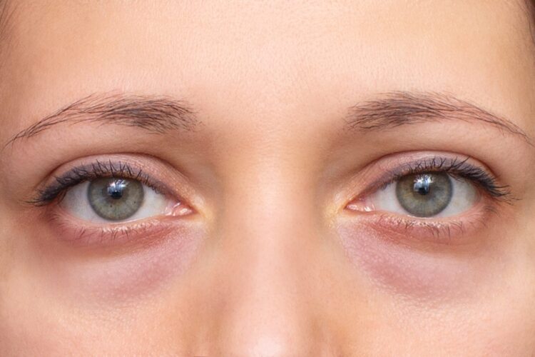 Blepharoplasty Manhattan & NYC