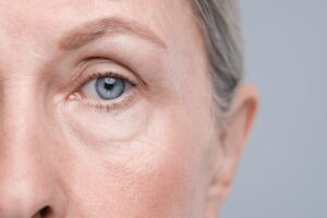 Brow Lift, Botox, Morpheus8, Manhattan & NYC